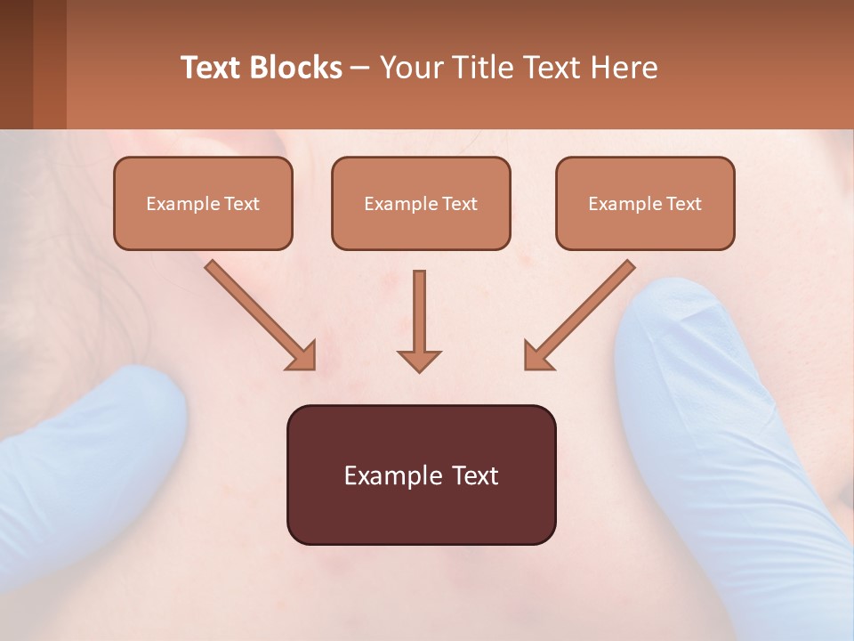 A Woman With Acne On Her Face And Blue Gloves PowerPoint Template