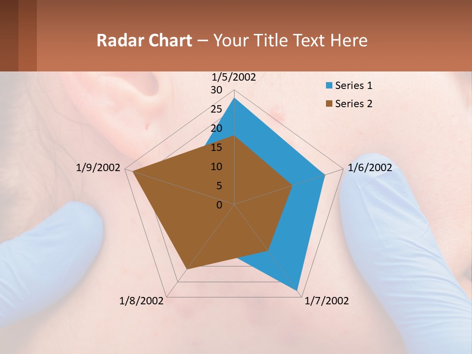 A Woman With Acne On Her Face And Blue Gloves PowerPoint Template