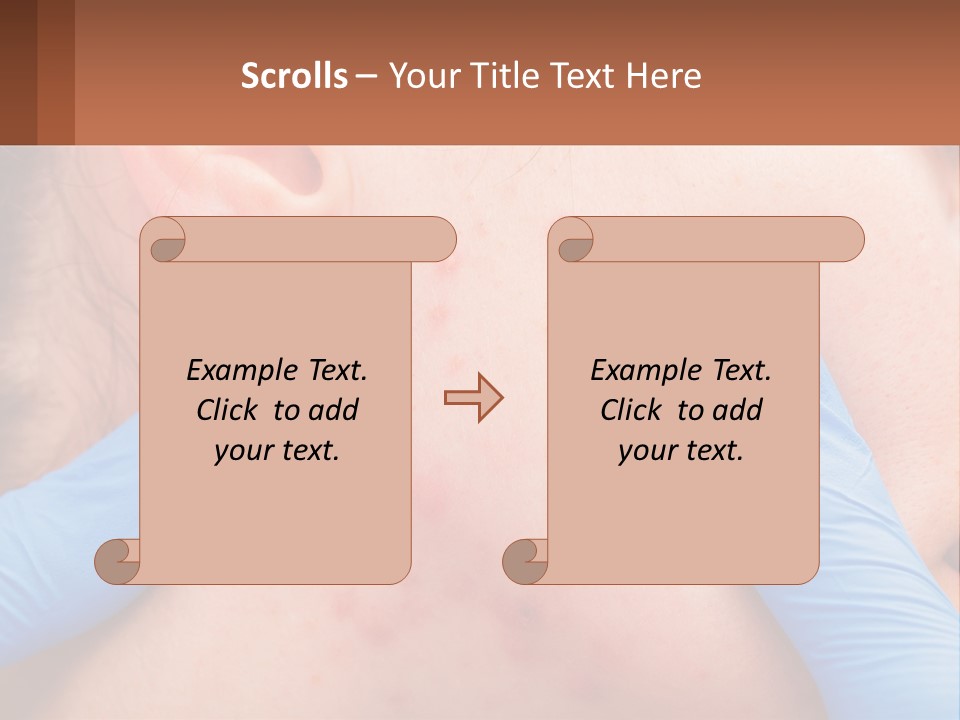 A Woman With Acne On Her Face And Blue Gloves PowerPoint Template