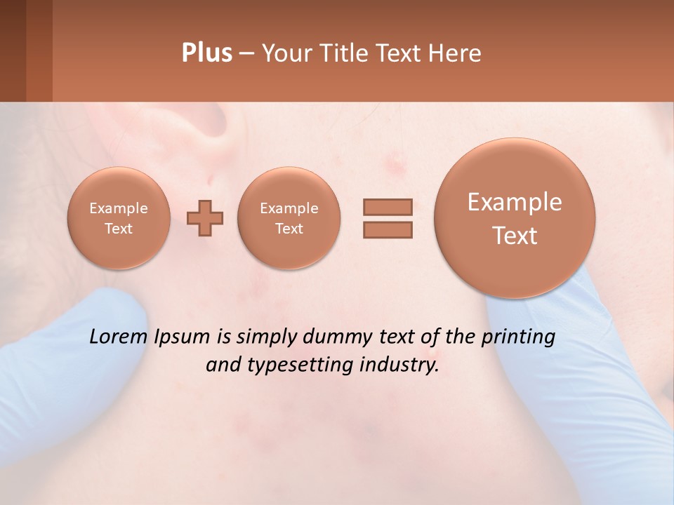 A Woman With Acne On Her Face And Blue Gloves PowerPoint Template