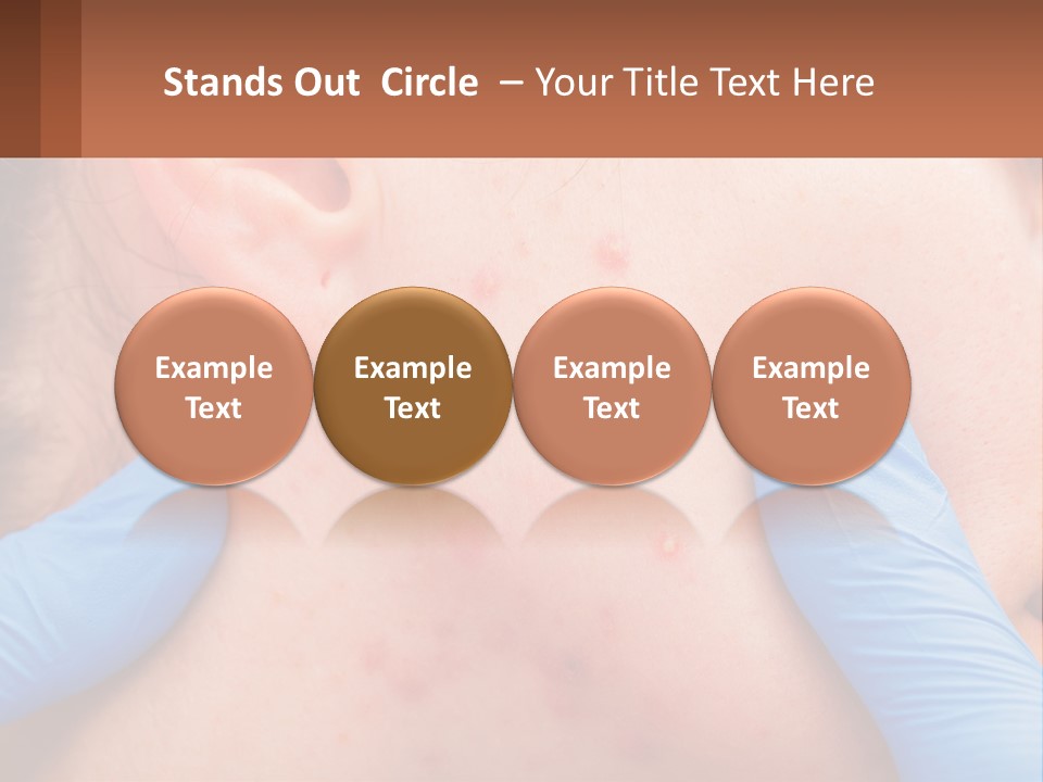 A Woman With Acne On Her Face And Blue Gloves PowerPoint Template