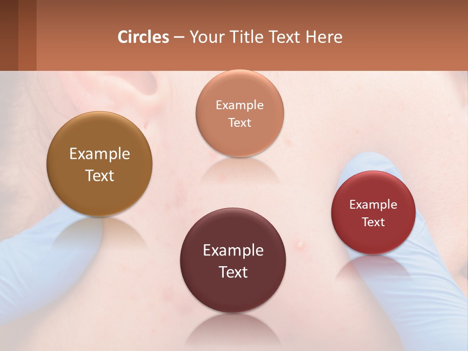 A Woman With Acne On Her Face And Blue Gloves PowerPoint Template