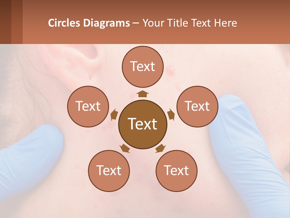 A Woman With Acne On Her Face And Blue Gloves PowerPoint Template