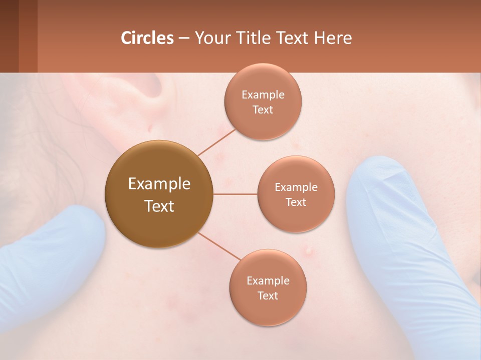 A Woman With Acne On Her Face And Blue Gloves PowerPoint Template