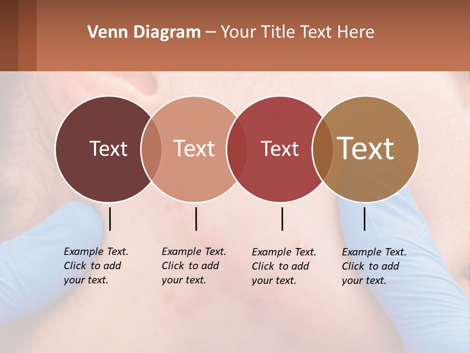 A Woman With Acne On Her Face And Blue Gloves PowerPoint Template