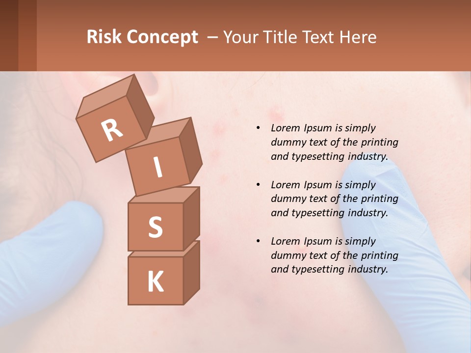 A Woman With Acne On Her Face And Blue Gloves PowerPoint Template