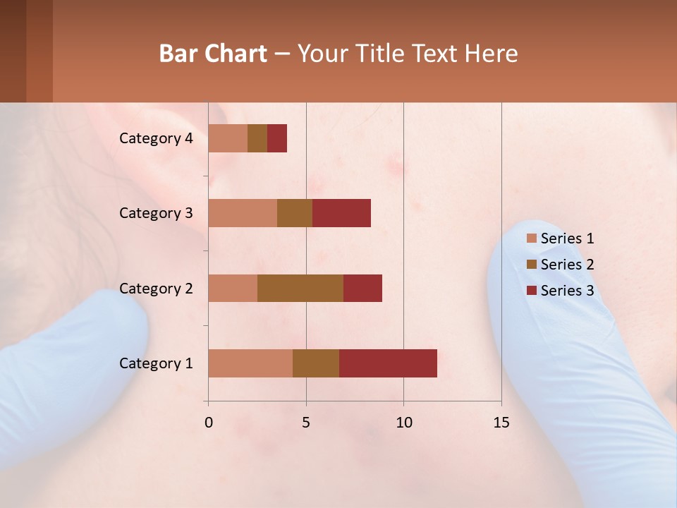 A Woman With Acne On Her Face And Blue Gloves PowerPoint Template