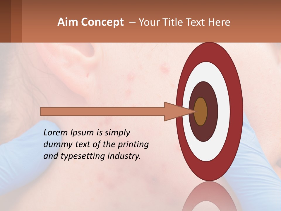 A Woman With Acne On Her Face And Blue Gloves PowerPoint Template