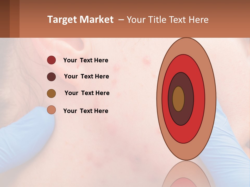 A Woman With Acne On Her Face And Blue Gloves PowerPoint Template