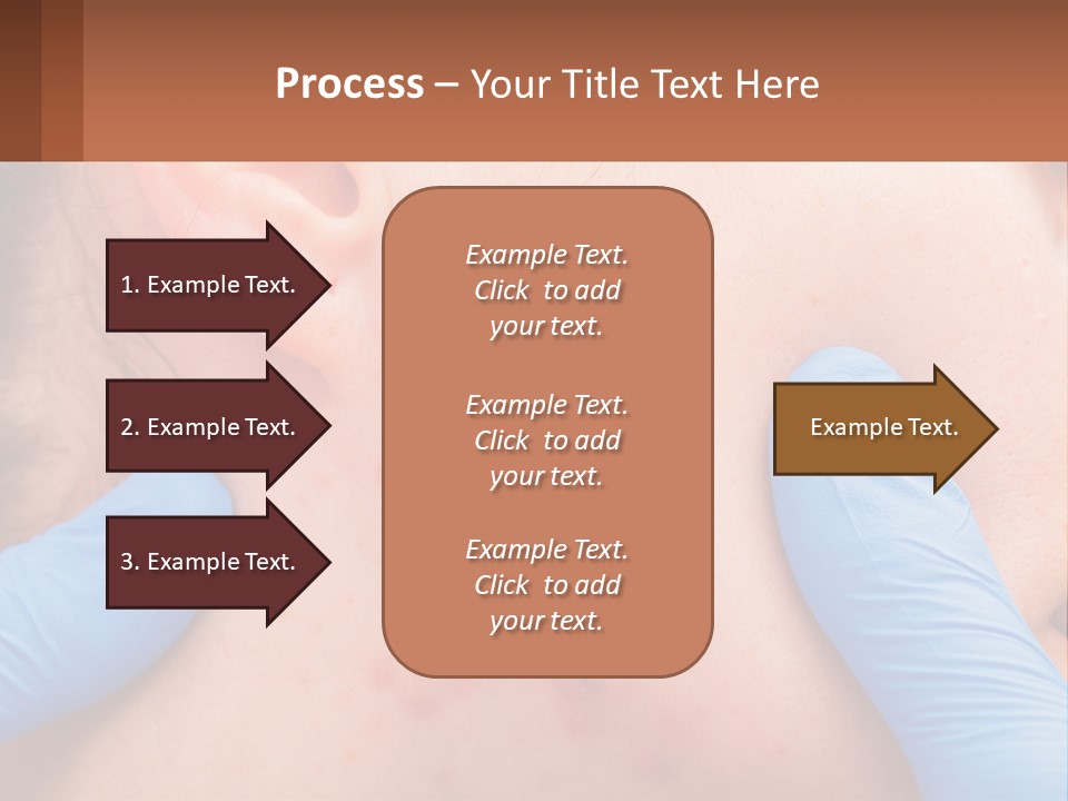 A Woman With Acne On Her Face And Blue Gloves PowerPoint Template