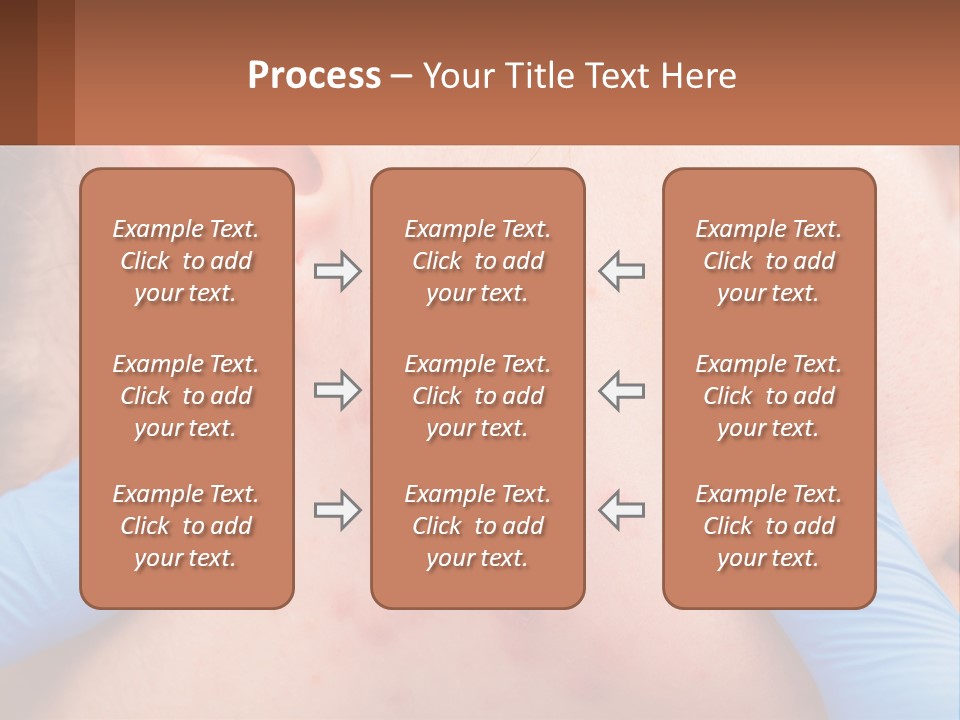 A Woman With Acne On Her Face And Blue Gloves PowerPoint Template