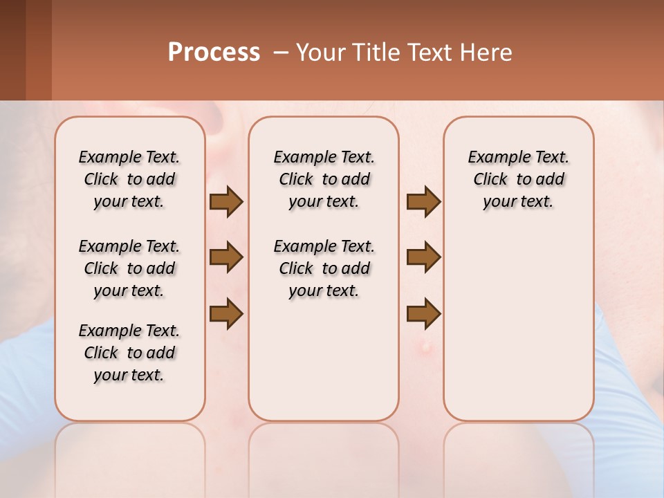A Woman With Acne On Her Face And Blue Gloves PowerPoint Template