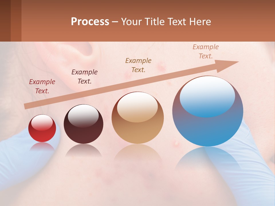 A Woman With Acne On Her Face And Blue Gloves PowerPoint Template