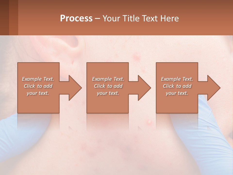 A Woman With Acne On Her Face And Blue Gloves PowerPoint Template