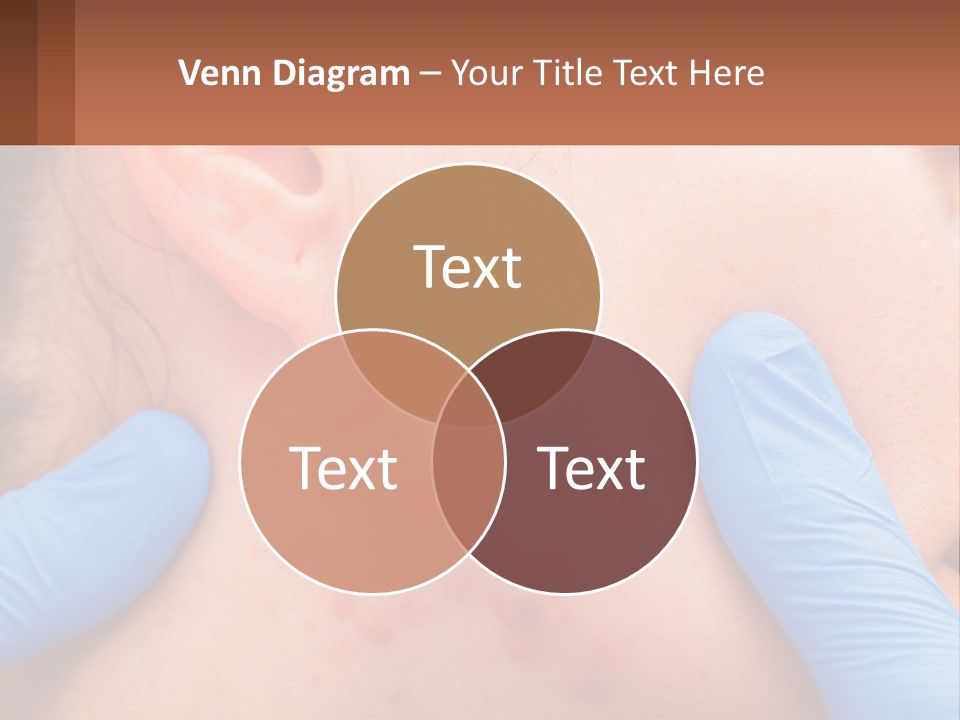 A Woman With Acne On Her Face And Blue Gloves PowerPoint Template