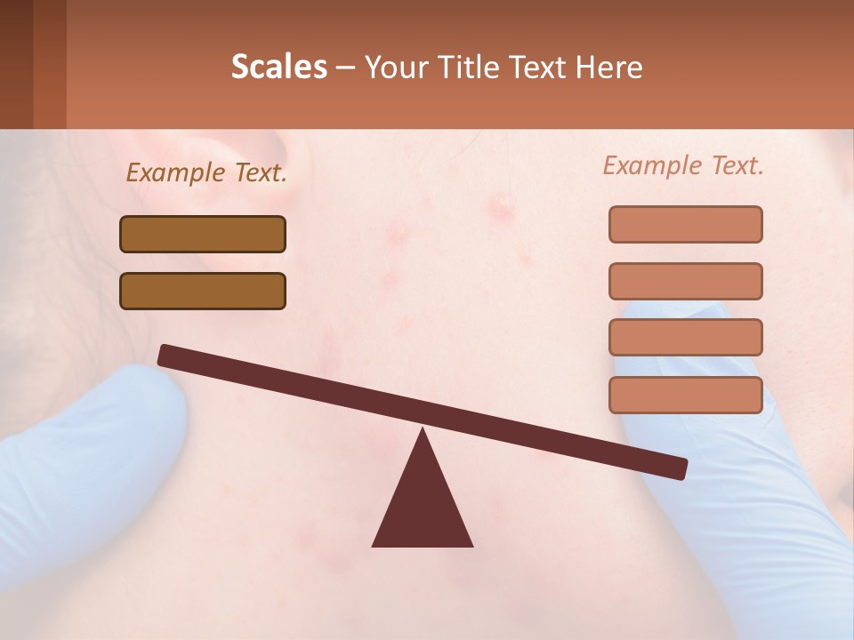 A Woman With Acne On Her Face And Blue Gloves PowerPoint Template