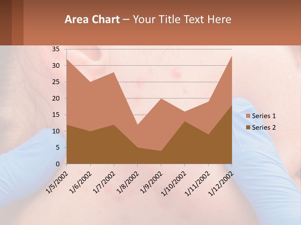 A Woman With Acne On Her Face And Blue Gloves PowerPoint Template
