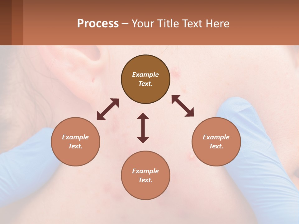 A Woman With Acne On Her Face And Blue Gloves PowerPoint Template