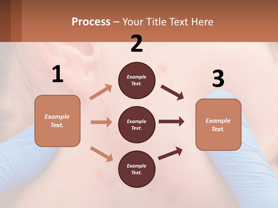 A Woman With Acne On Her Face And Blue Gloves PowerPoint Template