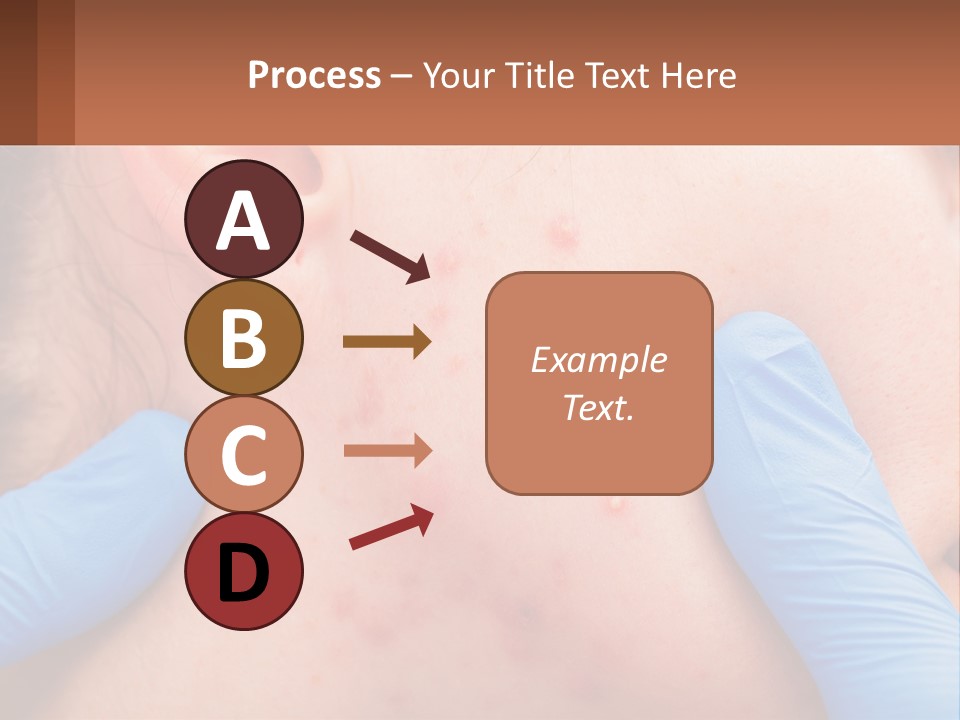 A Woman With Acne On Her Face And Blue Gloves PowerPoint Template