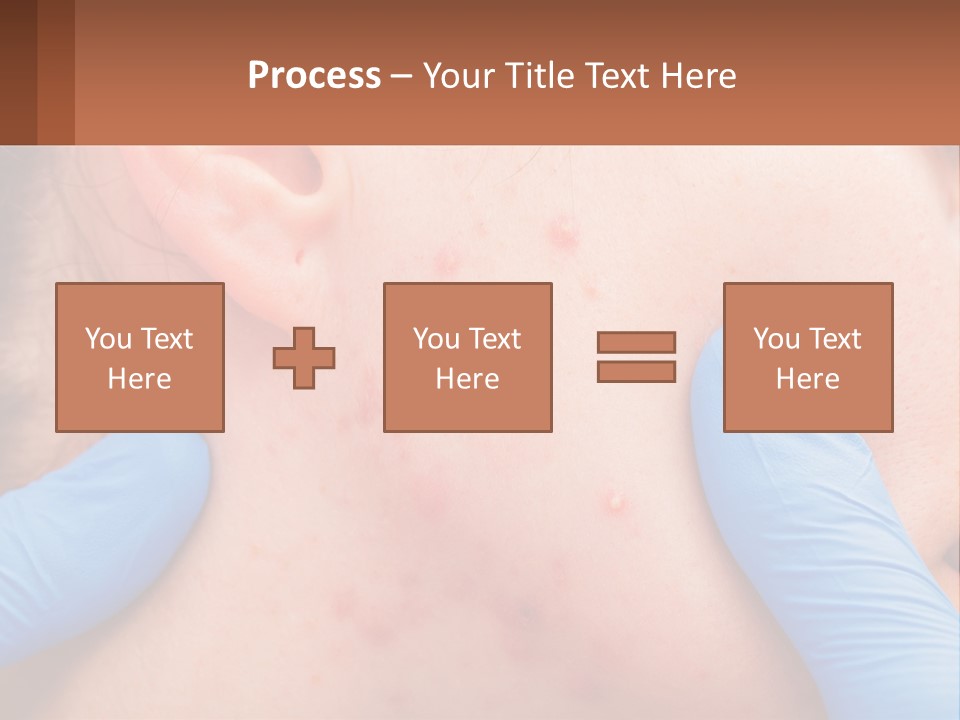 A Woman With Acne On Her Face And Blue Gloves PowerPoint Template