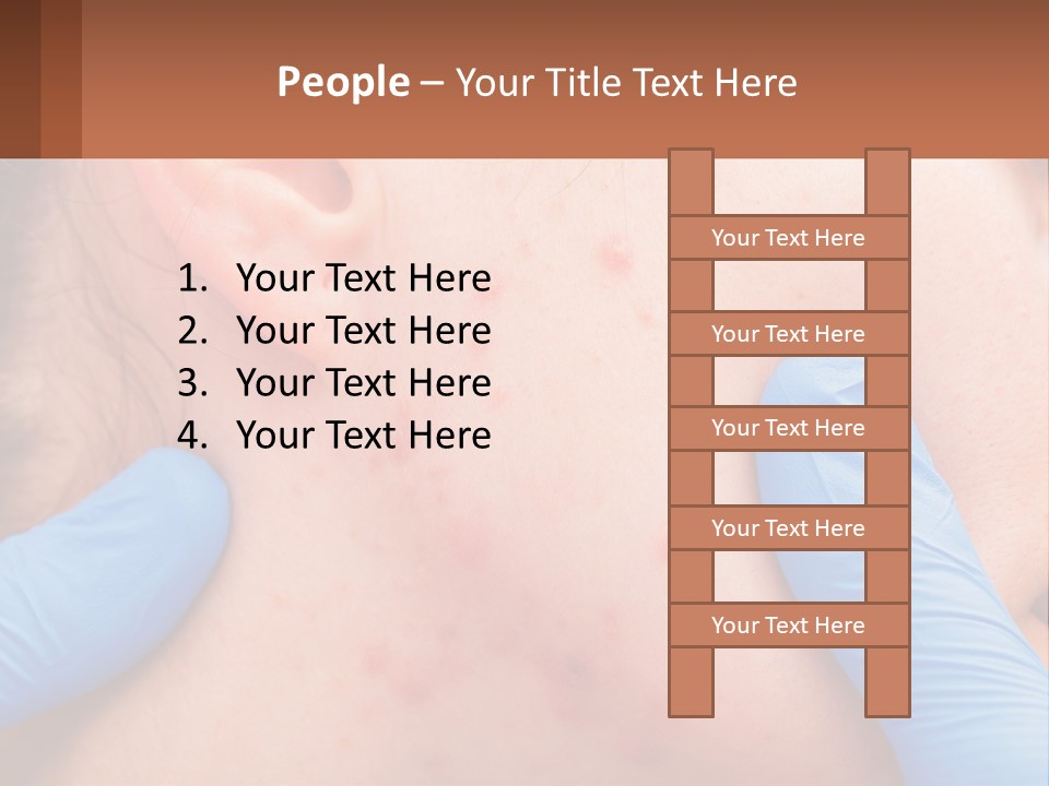 A Woman With Acne On Her Face And Blue Gloves PowerPoint Template