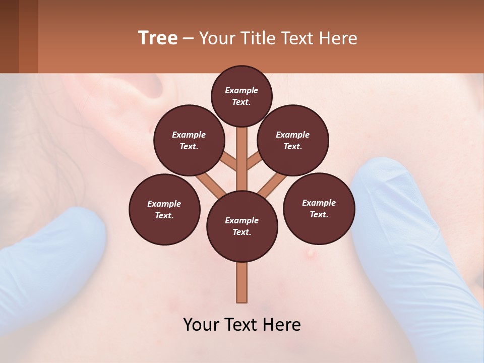 A Woman With Acne On Her Face And Blue Gloves PowerPoint Template