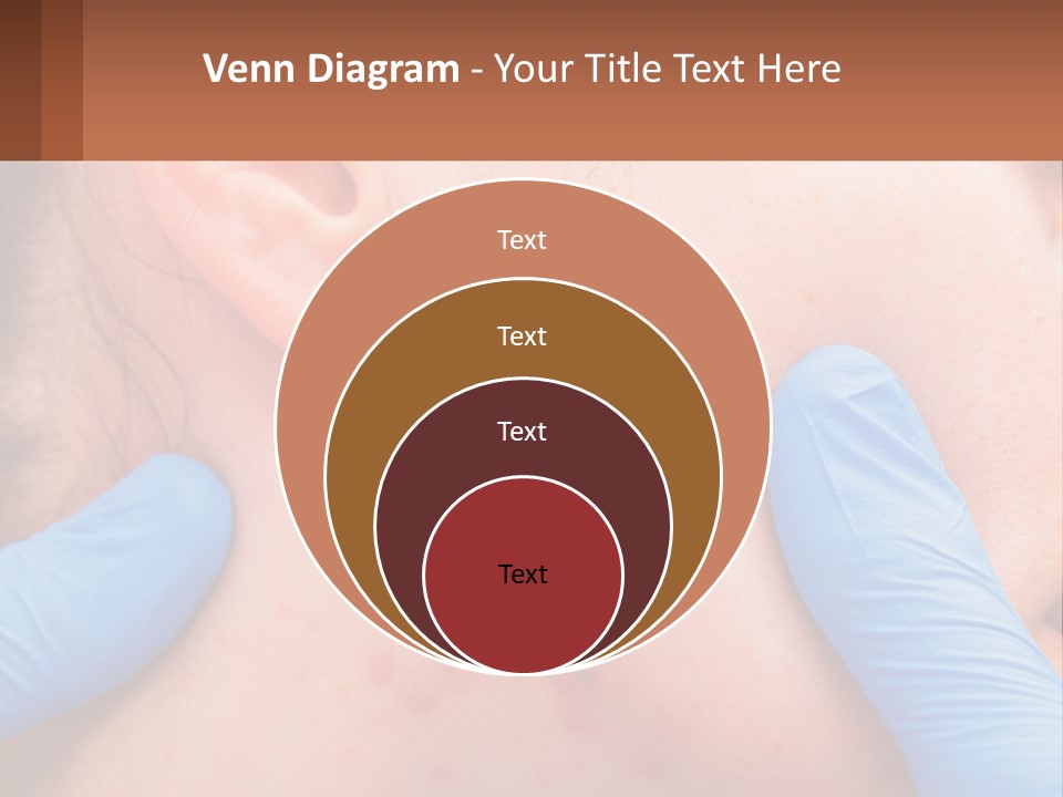 A Woman With Acne On Her Face And Blue Gloves PowerPoint Template