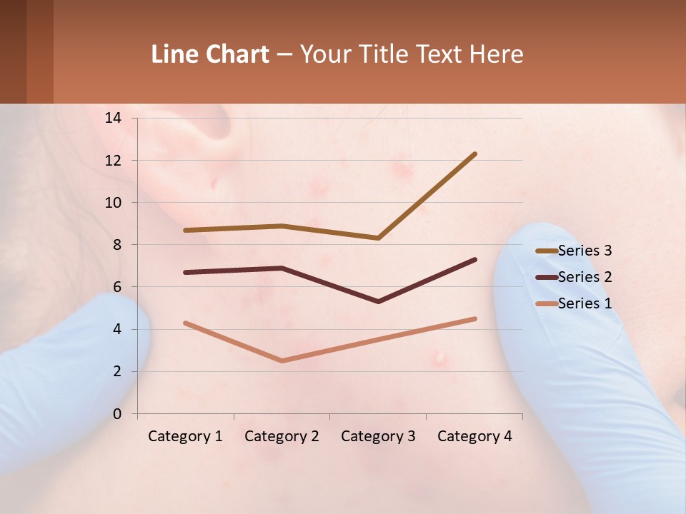A Woman With Acne On Her Face And Blue Gloves PowerPoint Template