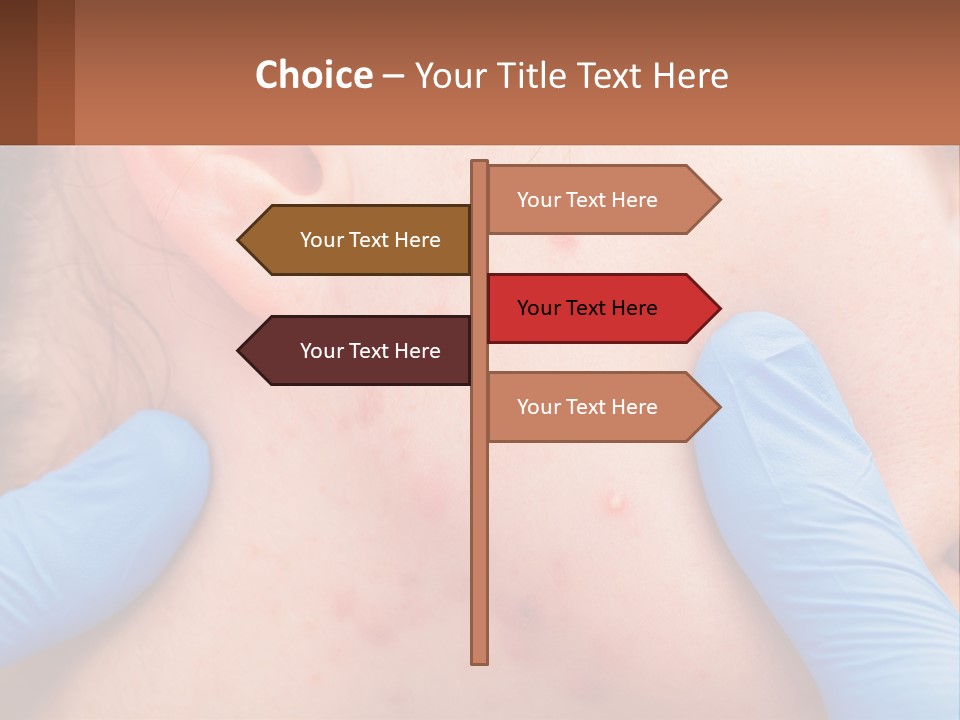 A Woman With Acne On Her Face And Blue Gloves PowerPoint Template