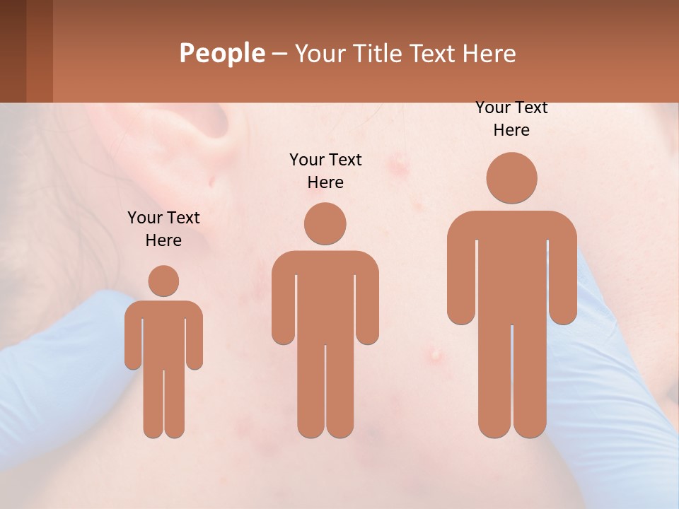 A Woman With Acne On Her Face And Blue Gloves PowerPoint Template