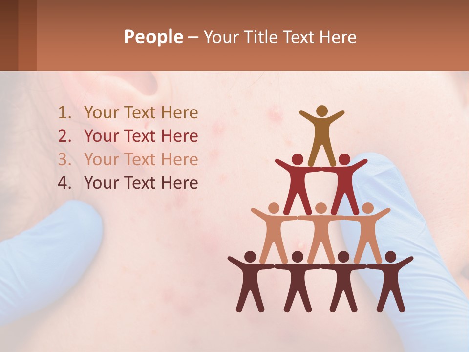 A Woman With Acne On Her Face And Blue Gloves PowerPoint Template