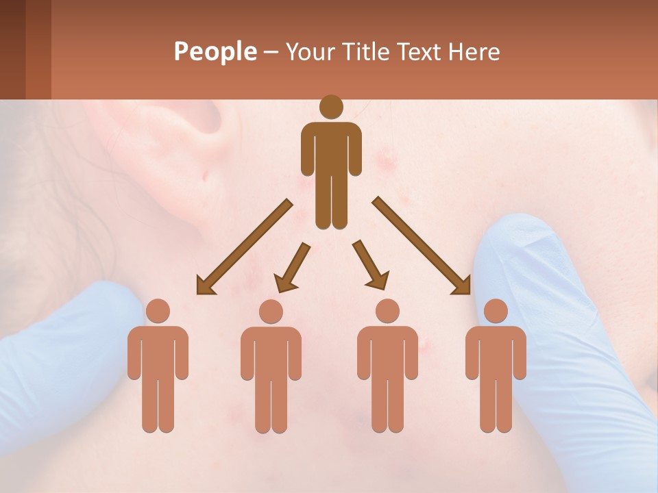 A Woman With Acne On Her Face And Blue Gloves PowerPoint Template