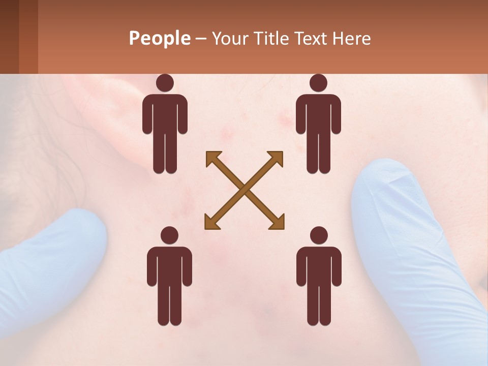 A Woman With Acne On Her Face And Blue Gloves PowerPoint Template