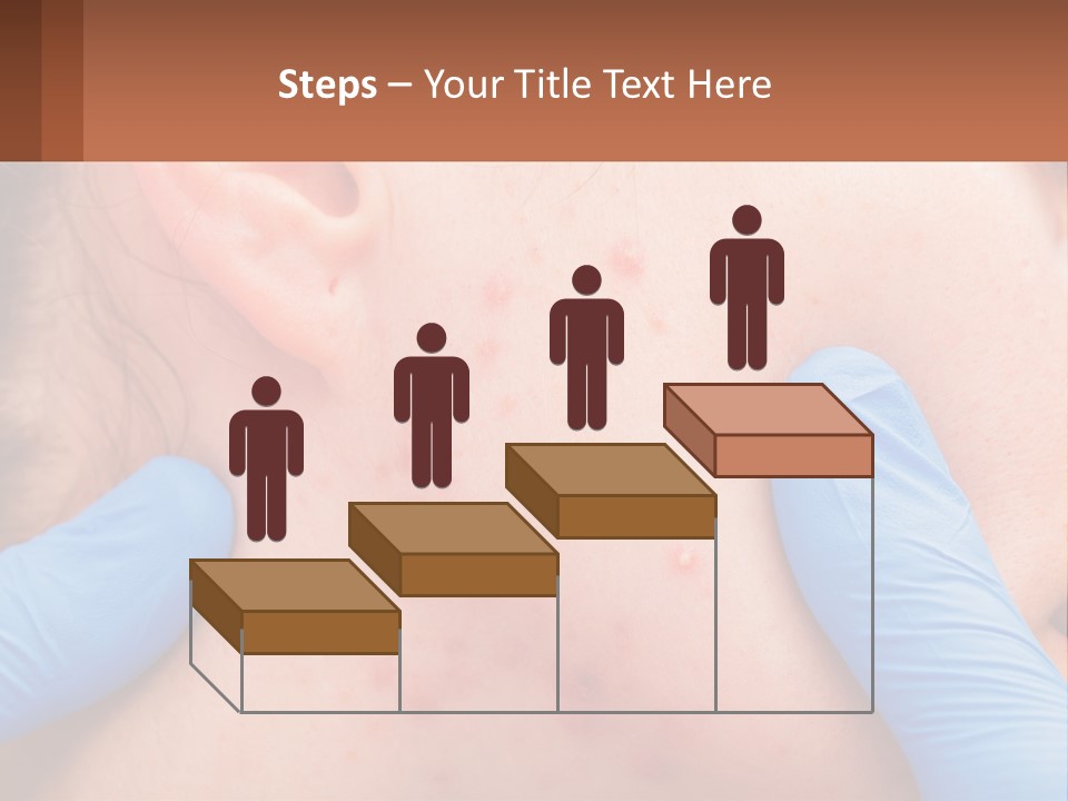 A Woman With Acne On Her Face And Blue Gloves PowerPoint Template