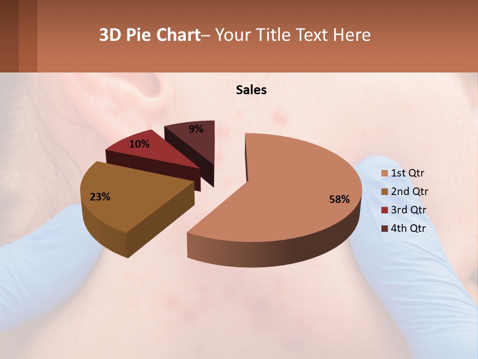 A Woman With Acne On Her Face And Blue Gloves PowerPoint Template