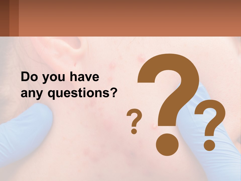 A Woman With Acne On Her Face And Blue Gloves PowerPoint Template