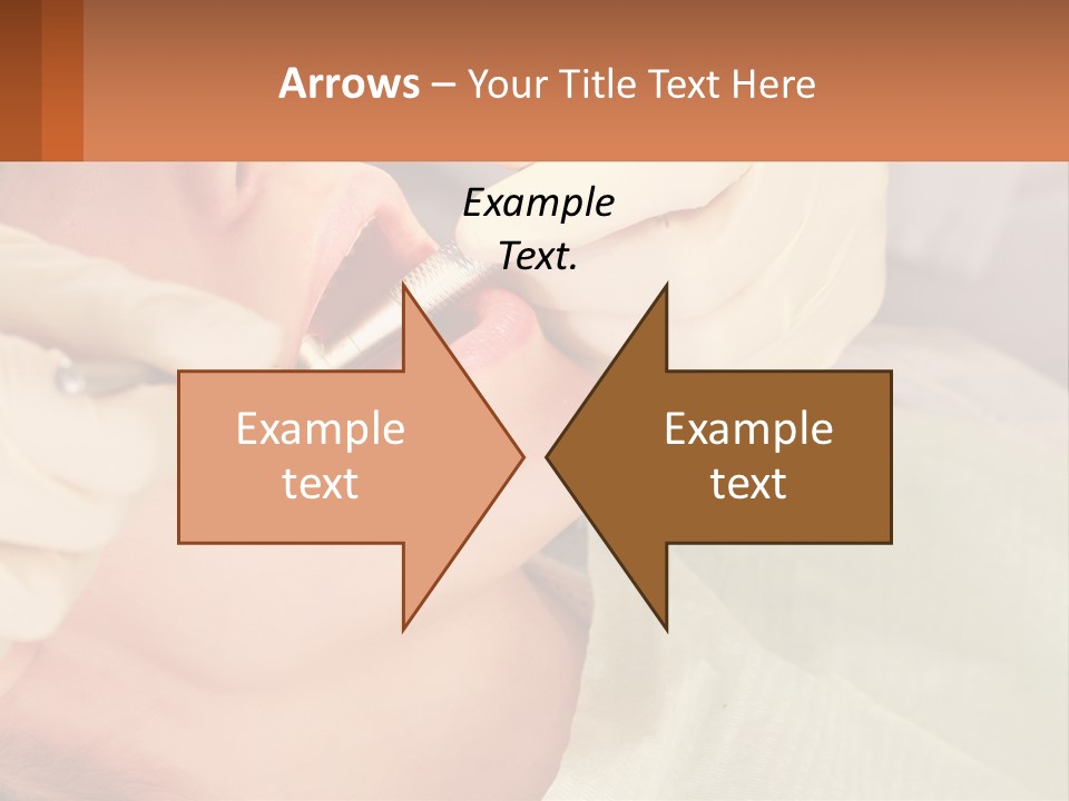 A Woman Getting Her Teeth Checked By A Dentist PowerPoint Template