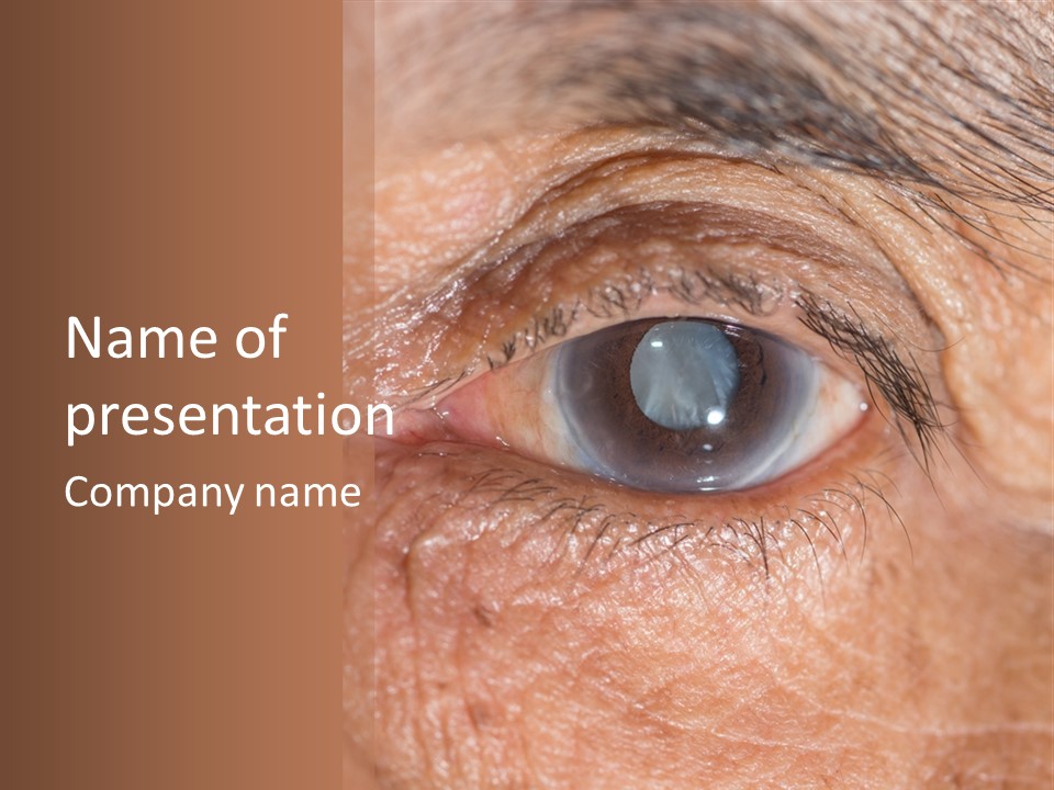 A Close Up Of An Eye With A Brown Background PowerPoint Template