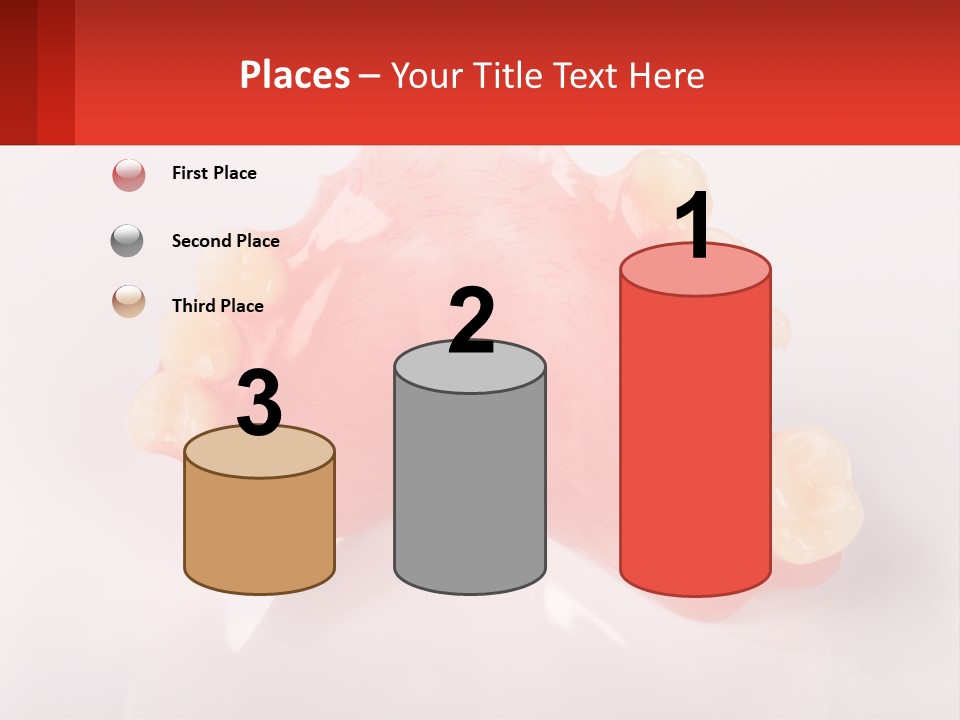 A Dental Model With Teeth And Gums On A White Background PowerPoint Template