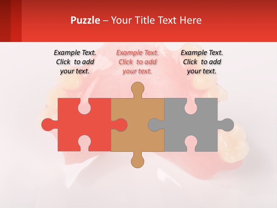 A Dental Model With Teeth And Gums On A White Background PowerPoint Template