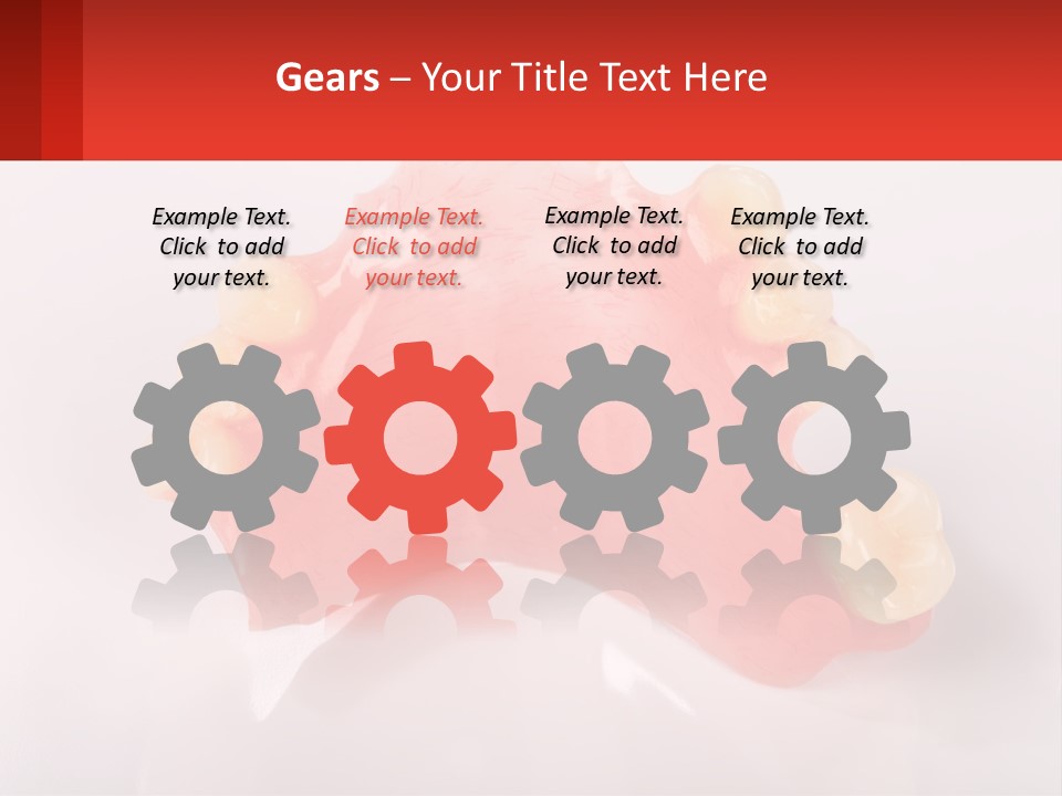 A Dental Model With Teeth And Gums On A White Background PowerPoint Template