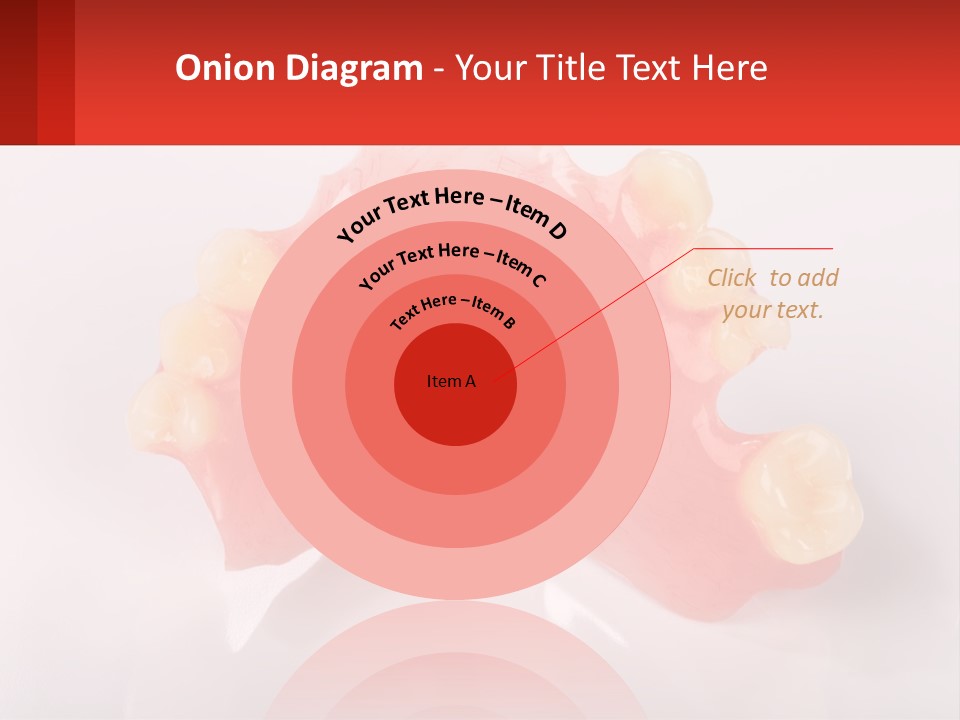 A Dental Model With Teeth And Gums On A White Background PowerPoint Template