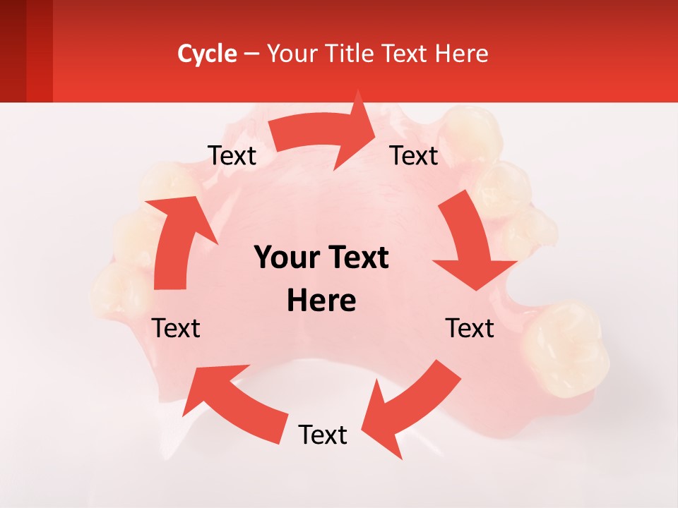 A Dental Model With Teeth And Gums On A White Background PowerPoint Template