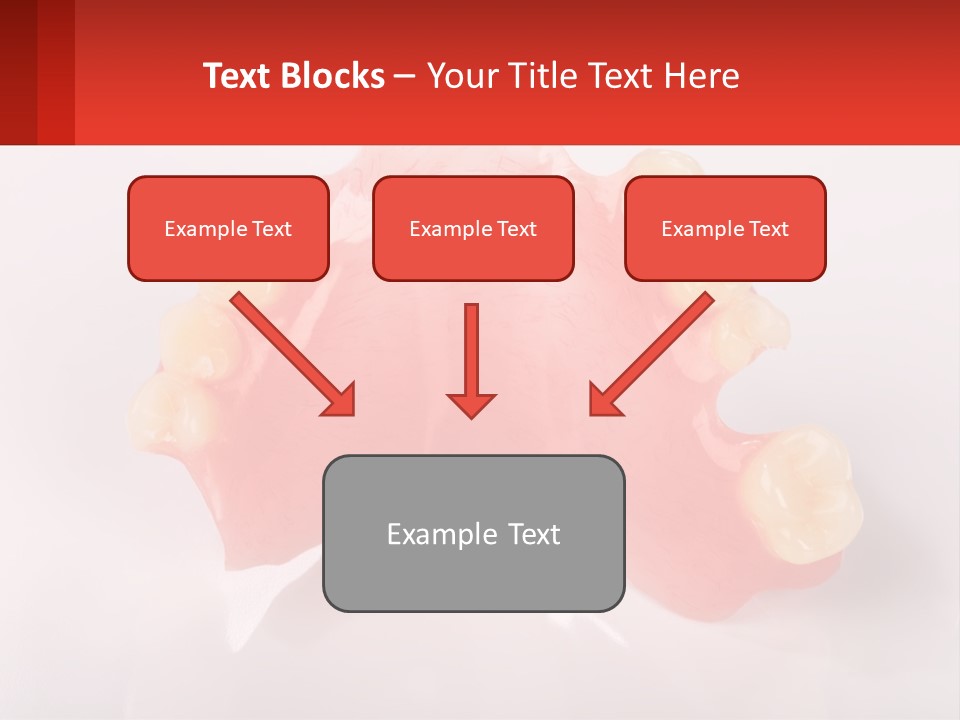 A Dental Model With Teeth And Gums On A White Background PowerPoint Template