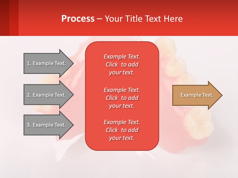 A Dental Model With Teeth And Gums On A White Background PowerPoint Template