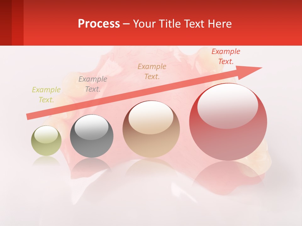 A Dental Model With Teeth And Gums On A White Background PowerPoint Template