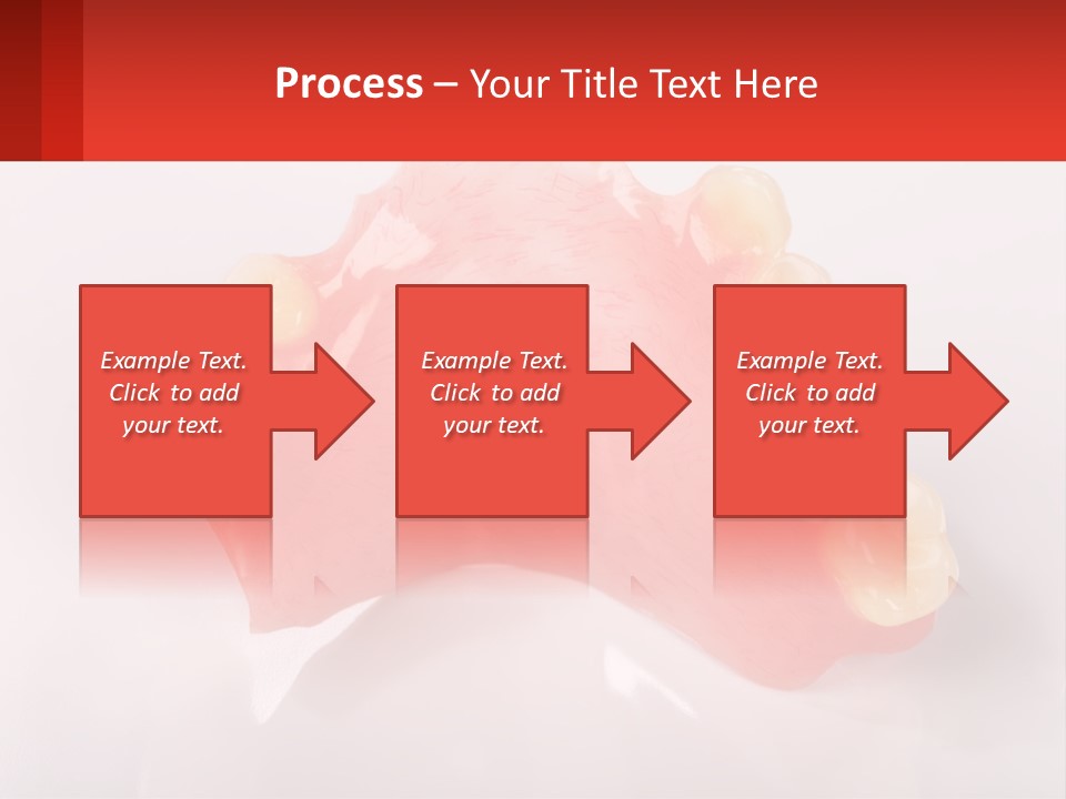 A Dental Model With Teeth And Gums On A White Background PowerPoint Template