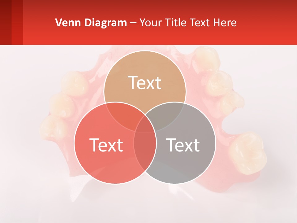 A Dental Model With Teeth And Gums On A White Background PowerPoint Template