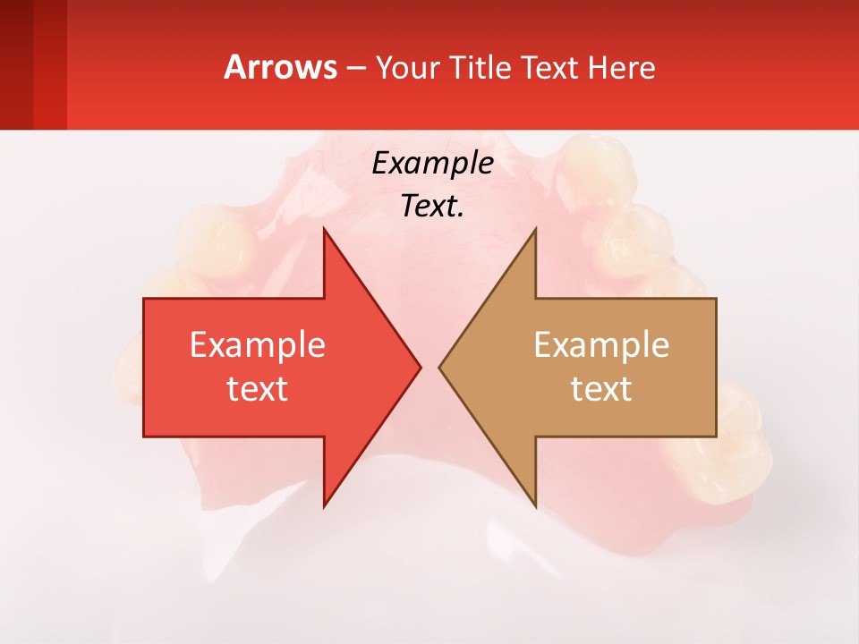 A Dental Model With Teeth And Gums On A White Background PowerPoint Template